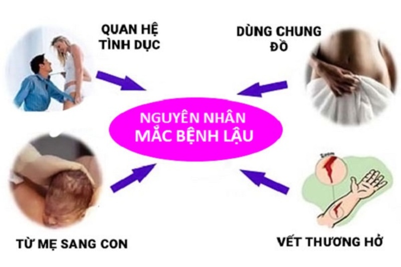 Bệnh lậu chủ yếu lây qua quan hệ tình dục không an toàn với người nhiễm vi khuẩn lậu. 