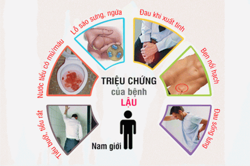 Triệu chứng bệnh lậu có thể khác nhau tùy giới tính và vị trí nhiễm khuẩn. 