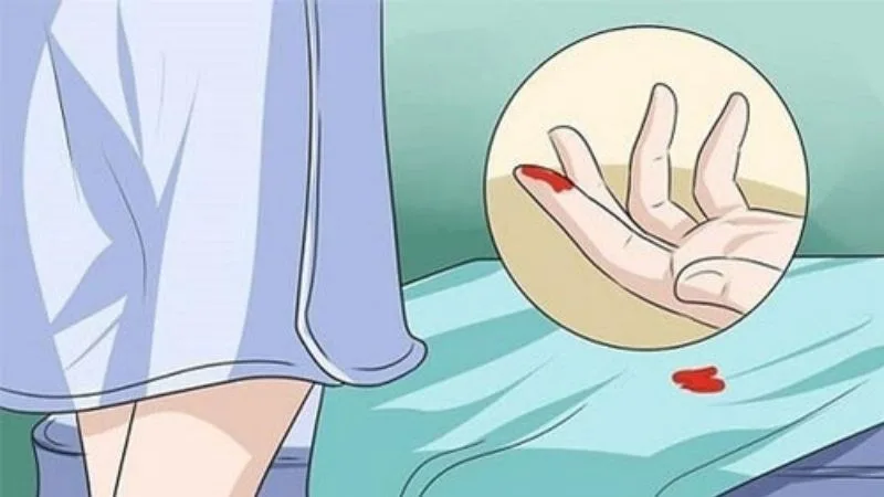 Dấu hiệu ung thư cổ tử cung như thế nào