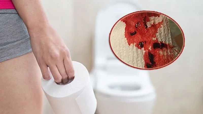Dấu hiệu ung thư cổ tử cung như thế nào